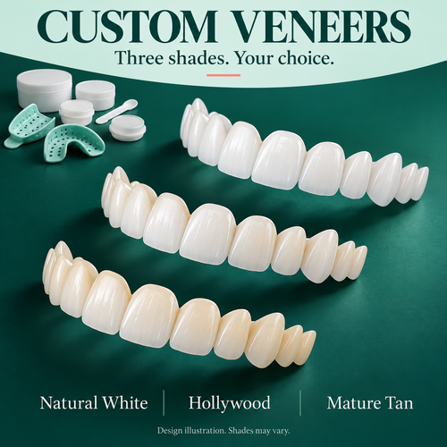 Custom veneer design illustration showing three shade choices and an illustrative impression kit